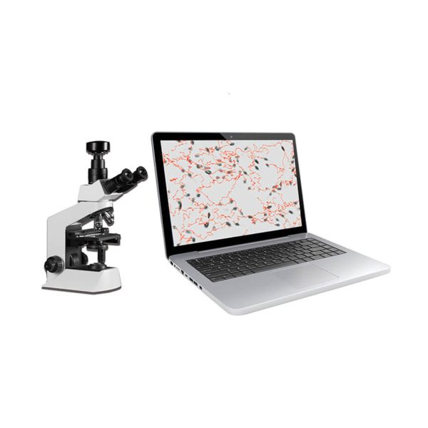 SW 3702 Laptop Sperm Quality Analyzer