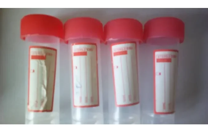 Universal Bottle (Stool) - Medical Grade Professional (Healthcare)