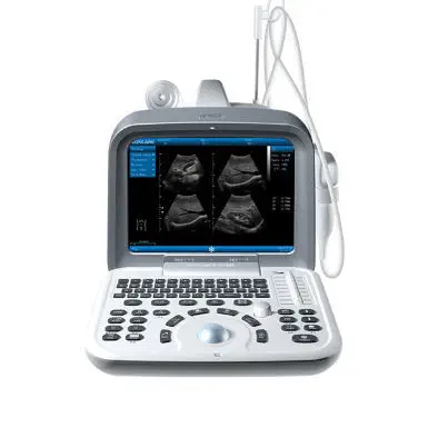 Portable ultrasound system ZQ-6602 - Medical Grade Professional (Healthcare)