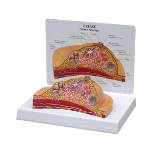 3B Scientific Breast Cross-Section Model – 3B Smart Anatomy - Medical Grade Professional (Healthcare)