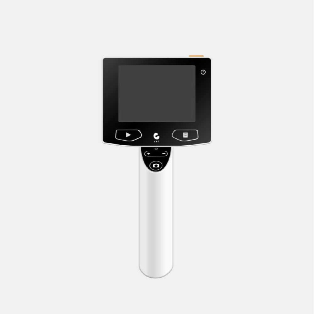 Ceitek Digital Otoscope HD Resolution DO382 - Medical Grade Professional (Healthcare)