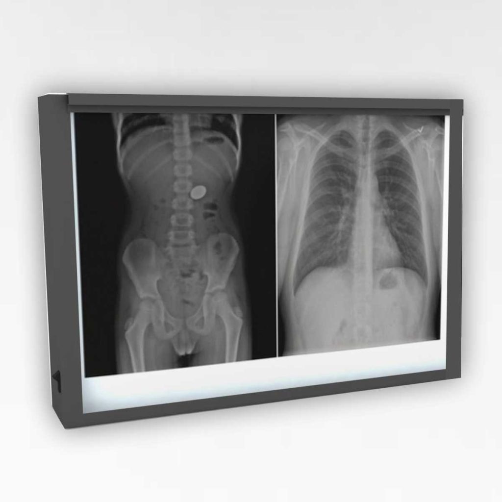 X-Ray LED Double Viewing Box - Medical Grade Professional (Healthcare)