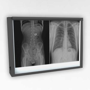 X-Ray LED Double Viewing Box - Medical Grade Professional (Healthcare)