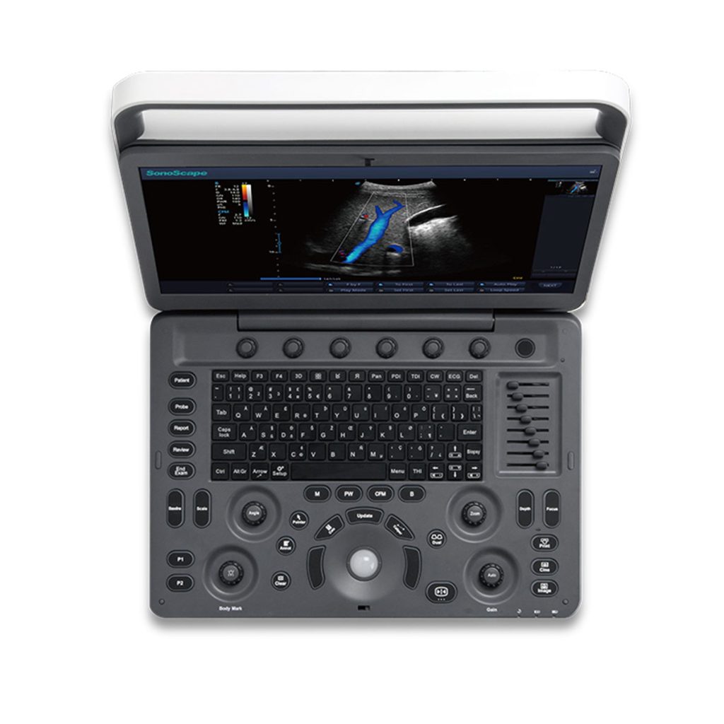 Ultrasound Machine - Sonoscape E2 - Color Ultrasound Scanner (Table Top) - Medical Grade Professional (Healthcare)