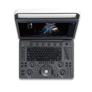Ultrasound Machine - Sonoscape E2 - Color Ultrasound Scanner (Table Top) - Medical Grade Professional (Healthcare)