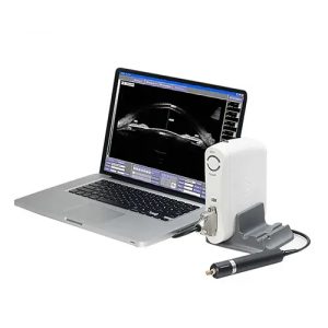 UBM Ultrasound Biomicroscopy Machine - Medical Grade Professional (Healthcare)