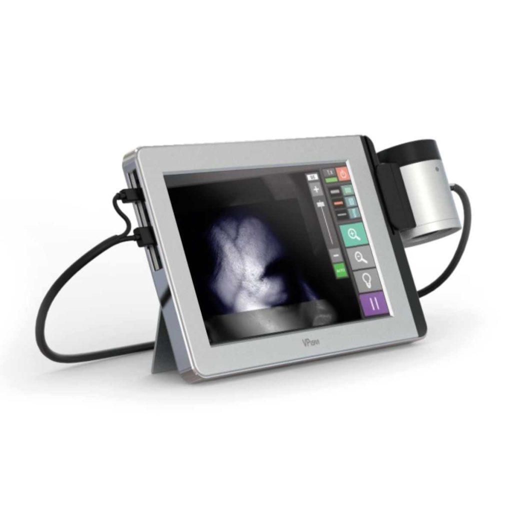 IISM VPism-C (Compact Type) Vein Probe - Medical Grade Professional (Healthcare)
