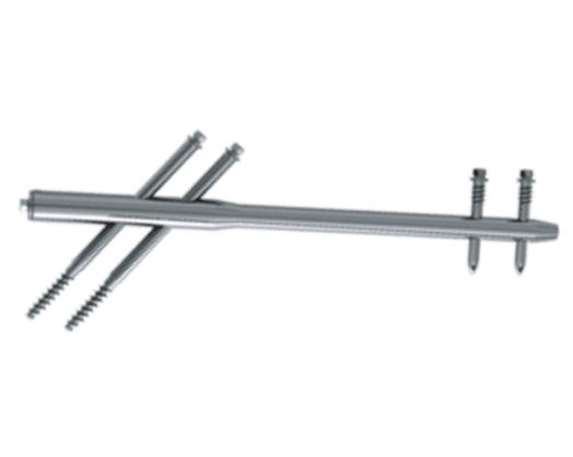 Trauma_Interlocking Nail Systems Reconstruction Femoral Interlocking Nail (Standard Gamma Nail) - Medical Grade Professional (Healthcare)