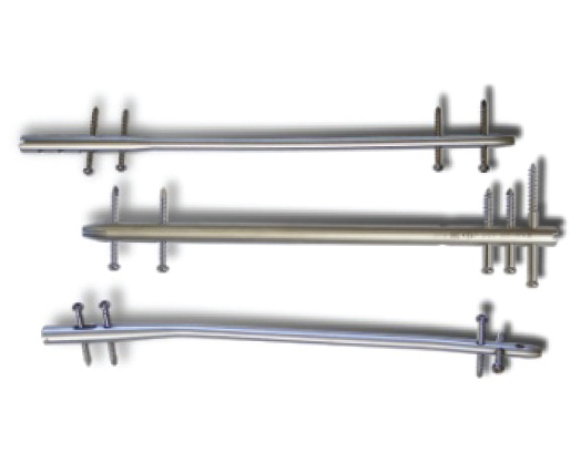Trauma_Interlocking Nail Systems Retrograde Femoral Interlocking Nail - Medical Grade Professional (Healthcare)