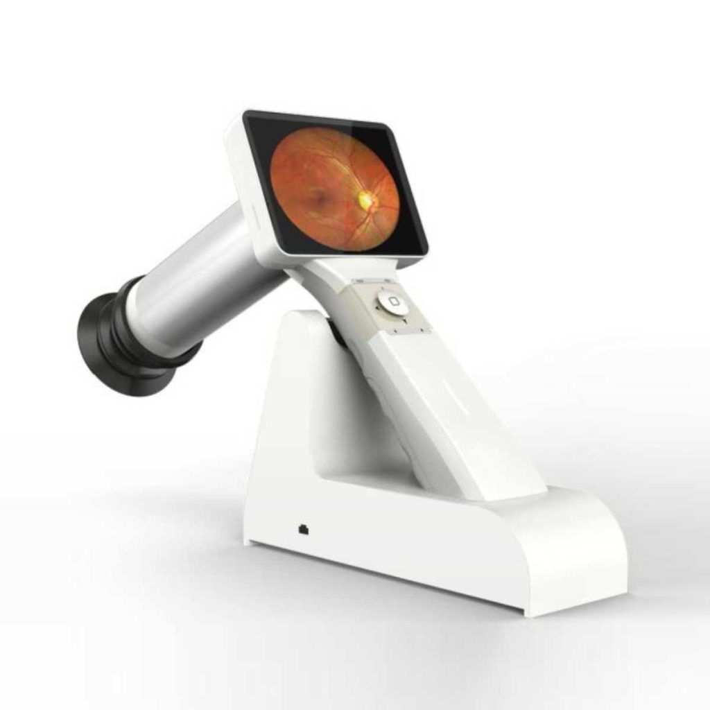 Portable Fundus Camera - Medical Grade Professional (Healthcare)
