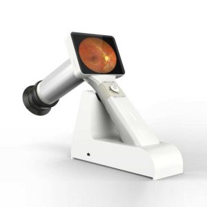 Portable Fundus Camera - Medical Grade Professional (Healthcare)