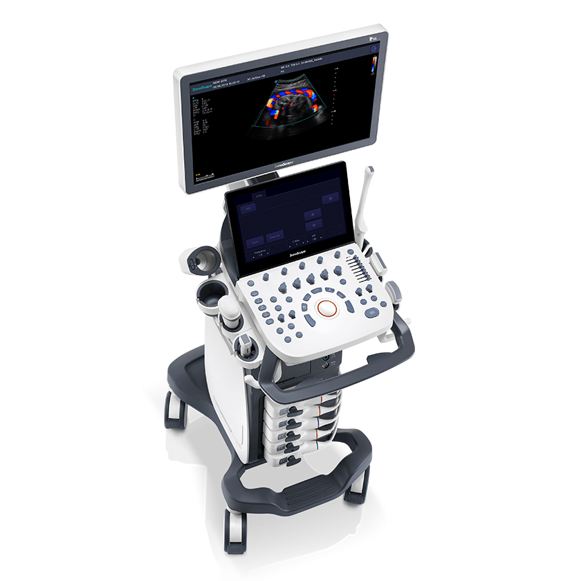 Sonoscape P15 Ultrasound Machine With Four Probes - Medical Grade Professional (Healthcare)