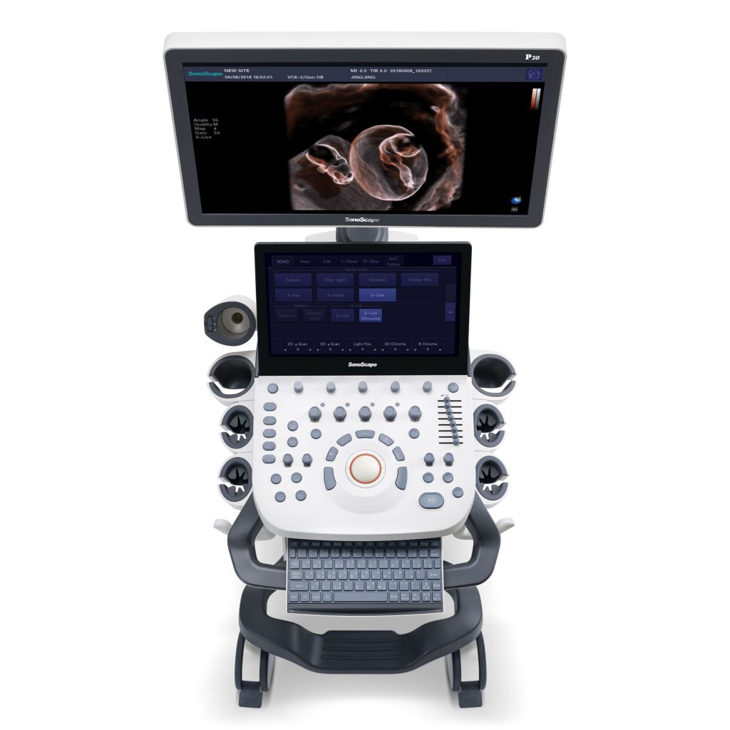 Sonoscape P20 Ultrasound Machine - Medical Grade Professional (Healthcare)