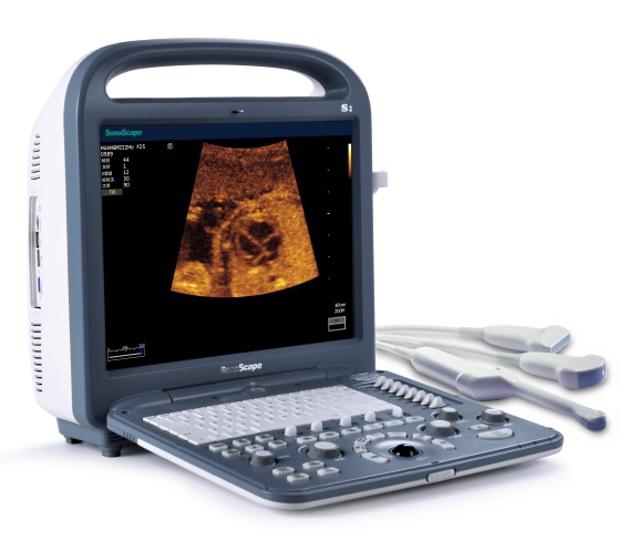 Sonoscape S2 Ultrasound - Medical Grade Professional (Healthcare)