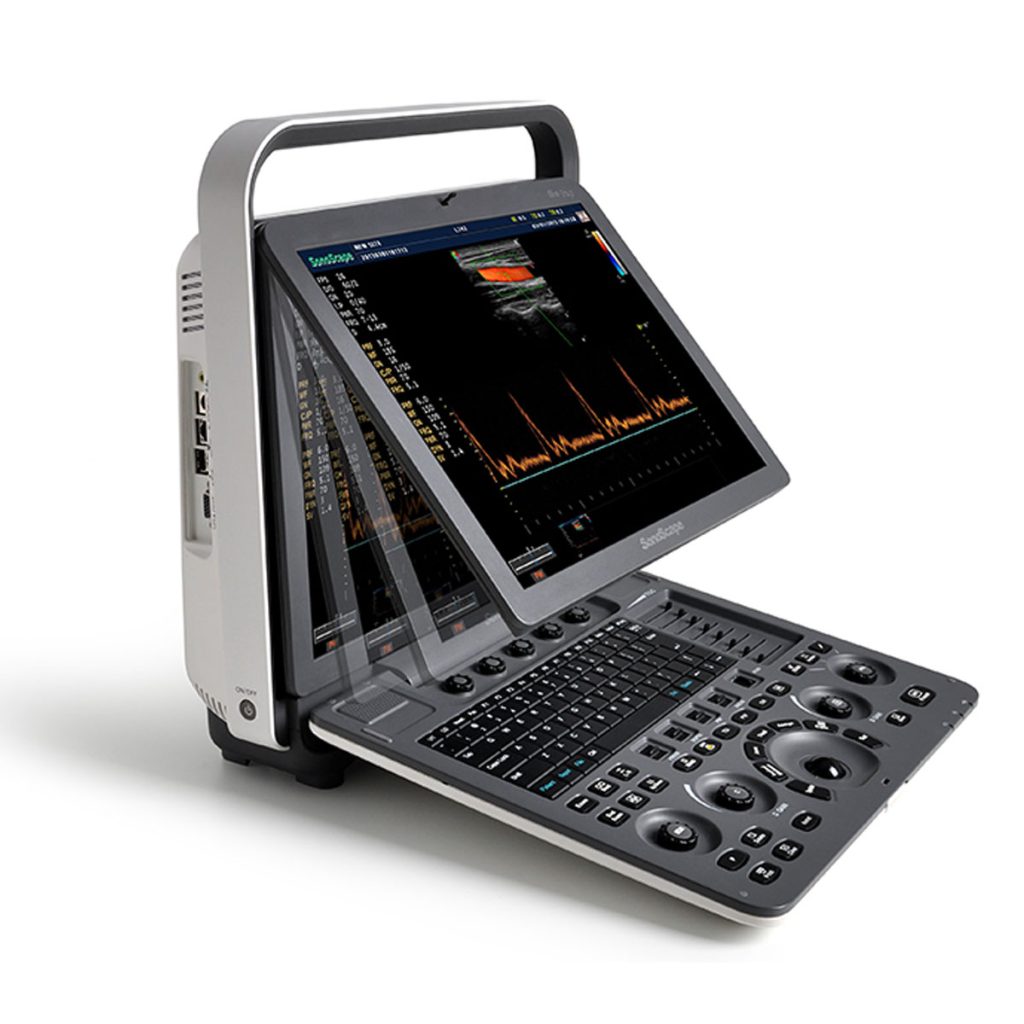 Sonoscape S8 Exp Portable Ultrasound - Medical Grade Professional (Healthcare)