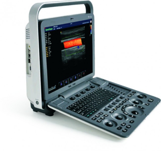 Sonoscape S8EXP Ultrasound - Medical Grade Professional (Healthcare)