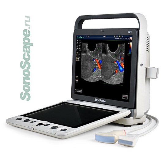 Sonoscape S9 Ultrasound - Medical Grade Professional (Healthcare)