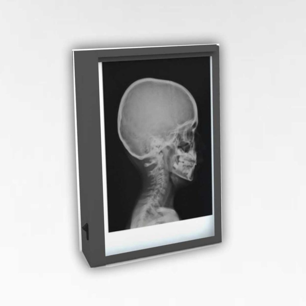X-Ray Viewing Box - Single - Medical Grade Professional (Healthcare)