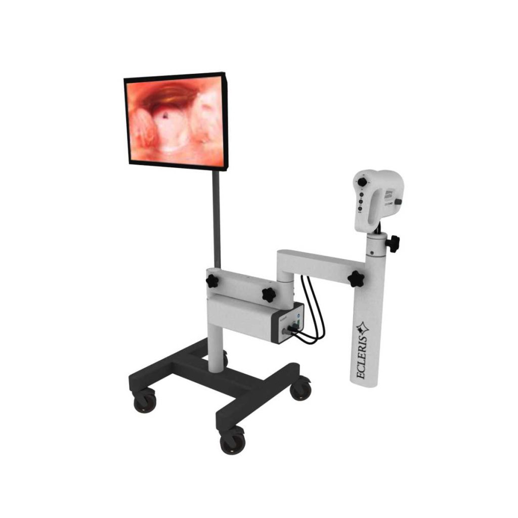 Ecleris HD Digital Video Colposcope - Medical Grade Professional (Healthcare)