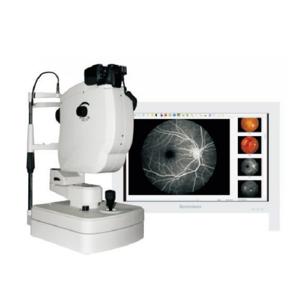 Fundus Camera - Medical Grade Professional (Healthcare)
