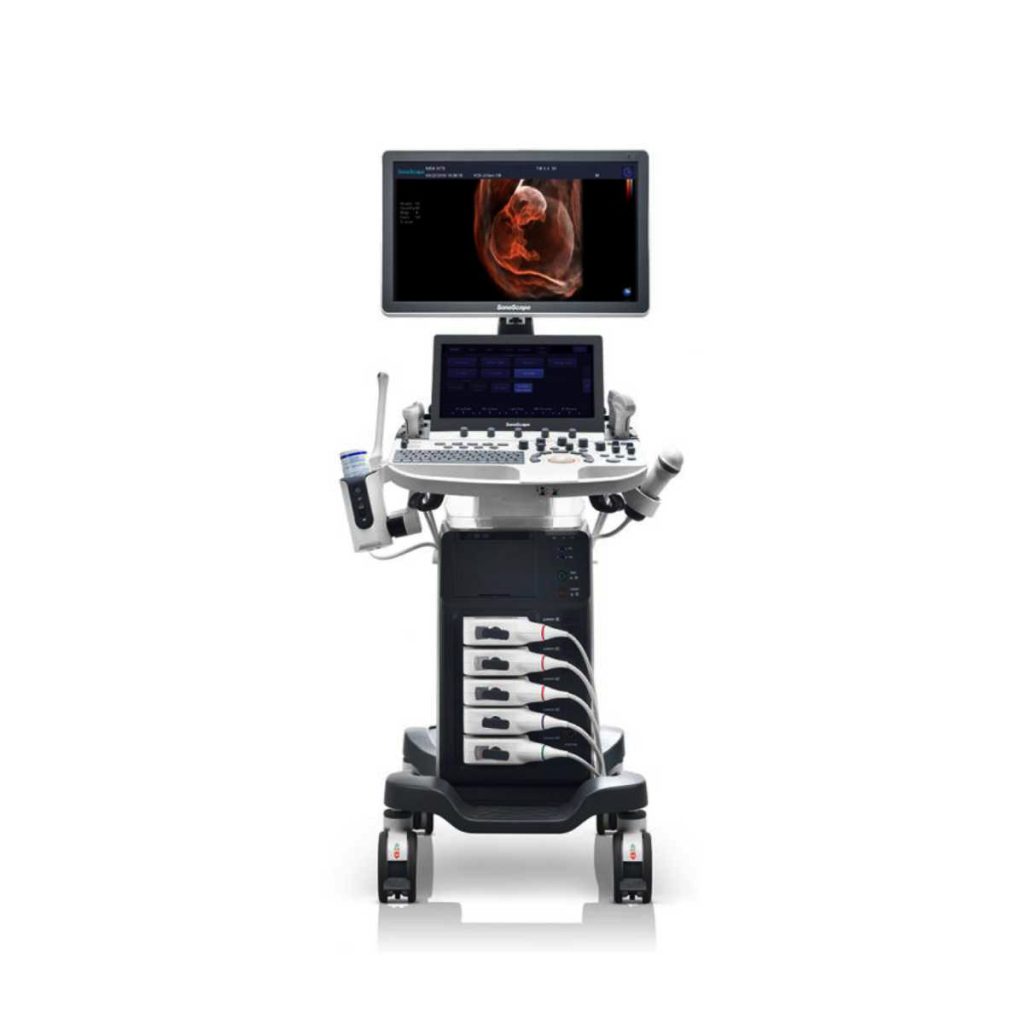 Sonoscape P50 Ultrasound Machine - Medical Grade Professional (Healthcare)