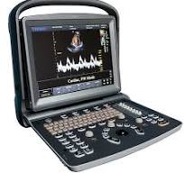 Chison ECO 5 Portable Color Doppler Ultrasound System - Medical Grade Professional (Healthcare)