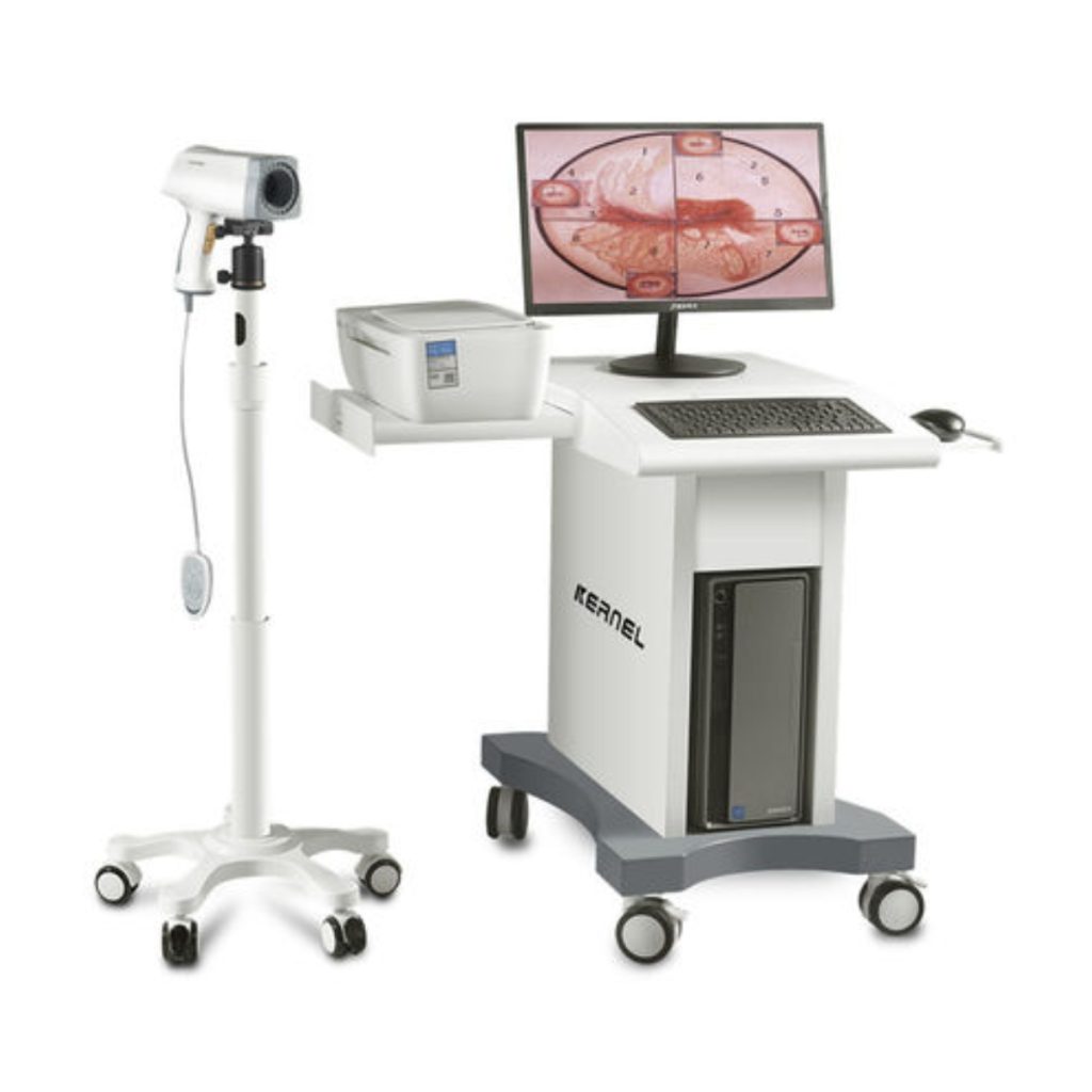 KN-2200 Video Colposcope - Medical Grade Professional (Healthcare)