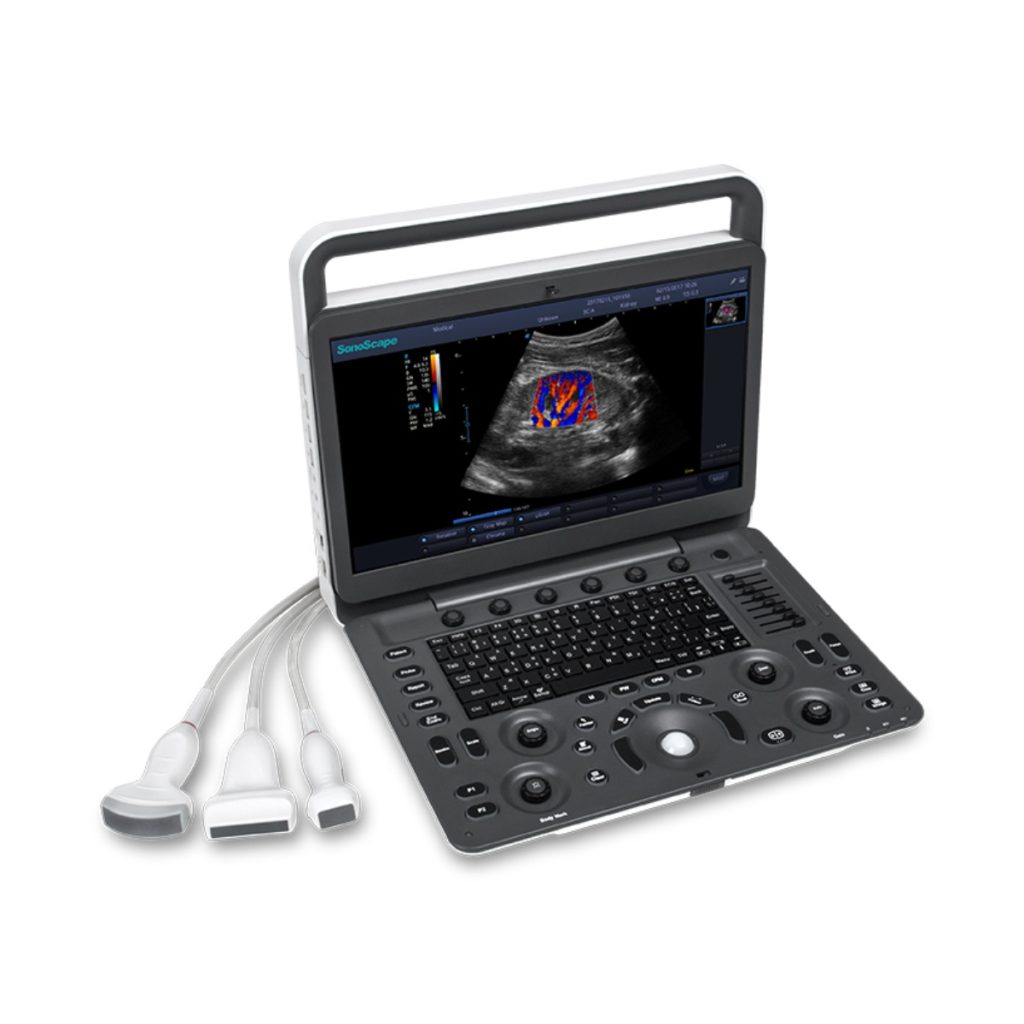 Sonoscape E3 Ultrasound Machine - Medical Grade Professional (Healthcare)