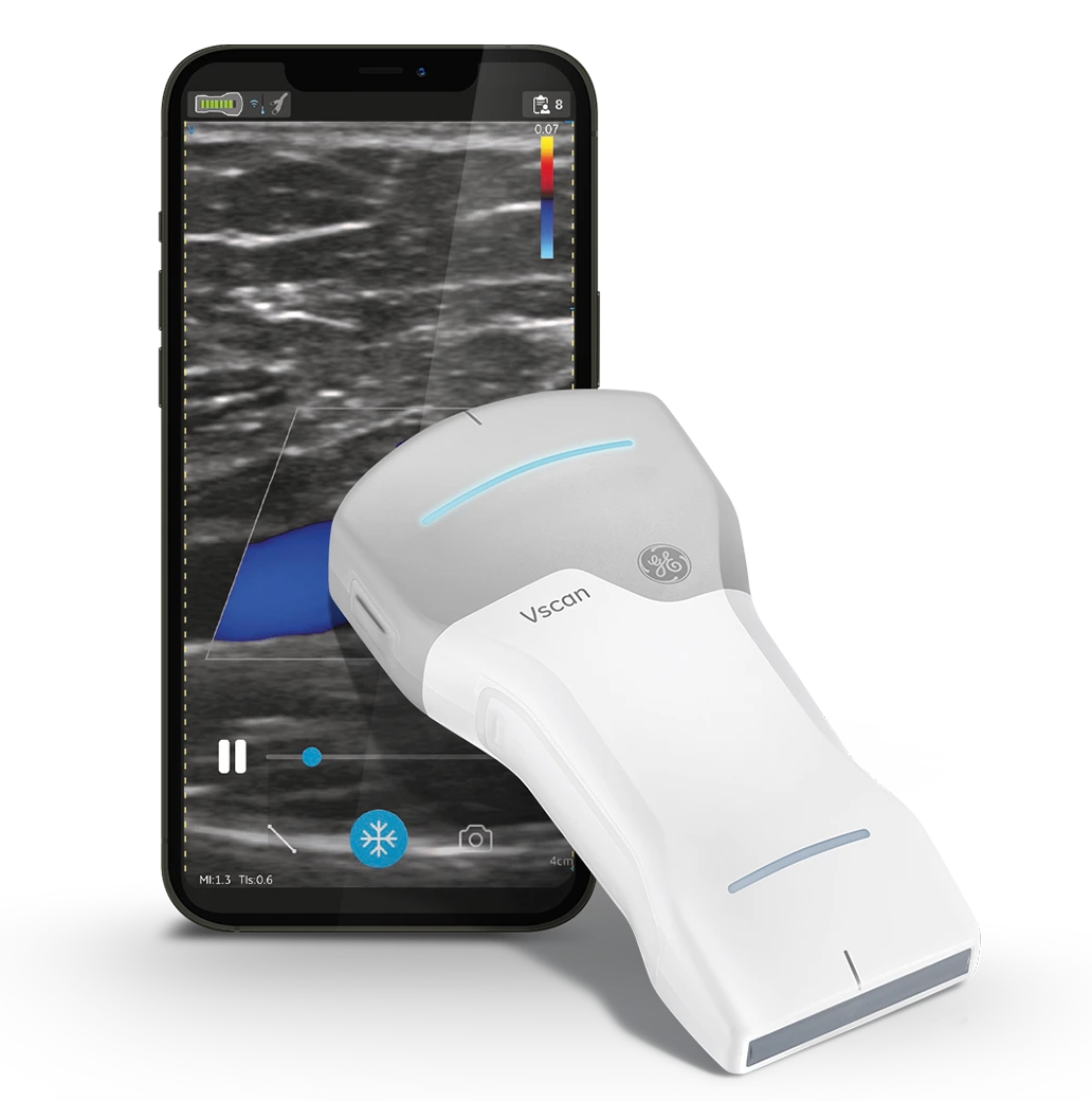Vscan Air™ Portable Ultrasound Systems - Medical Grade Professional (Healthcare)